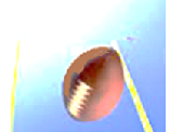 field goal